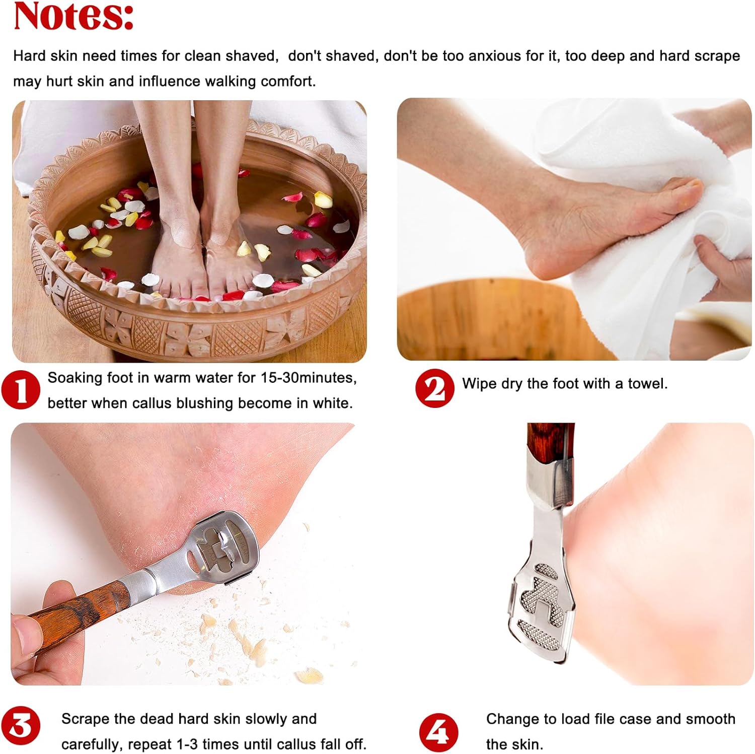 Pedicure Callus Shaver Set Sta - Woodworking Rasps And Files ulasan dan harga